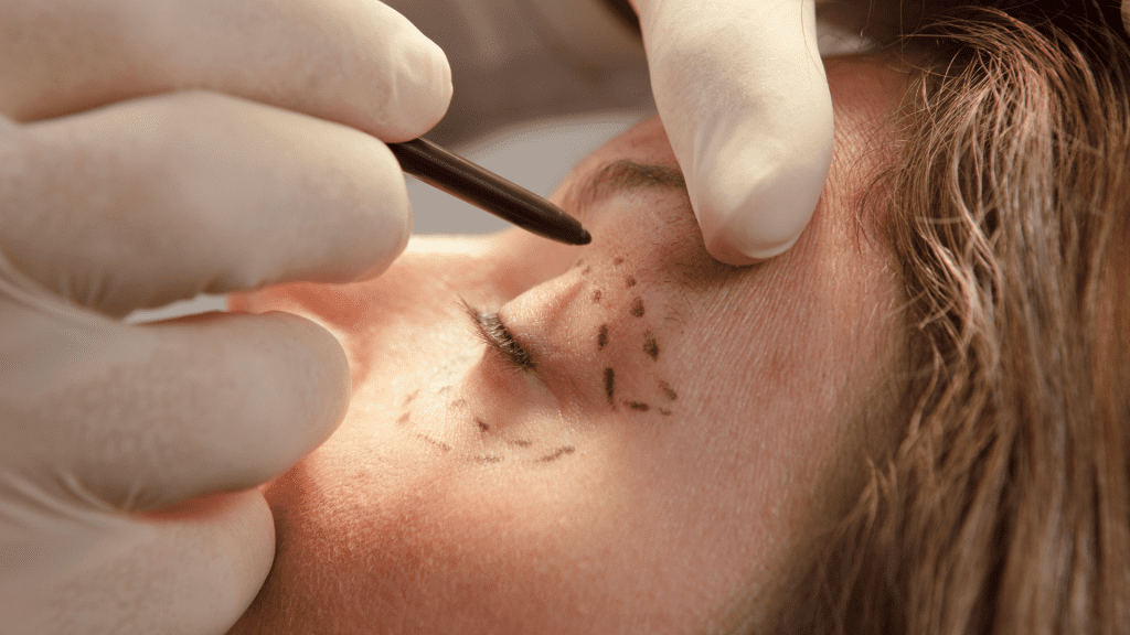 czy plastyka powiek jest bezpieczna